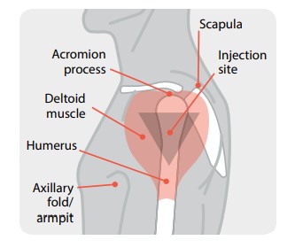 diagram of proper vaccine location