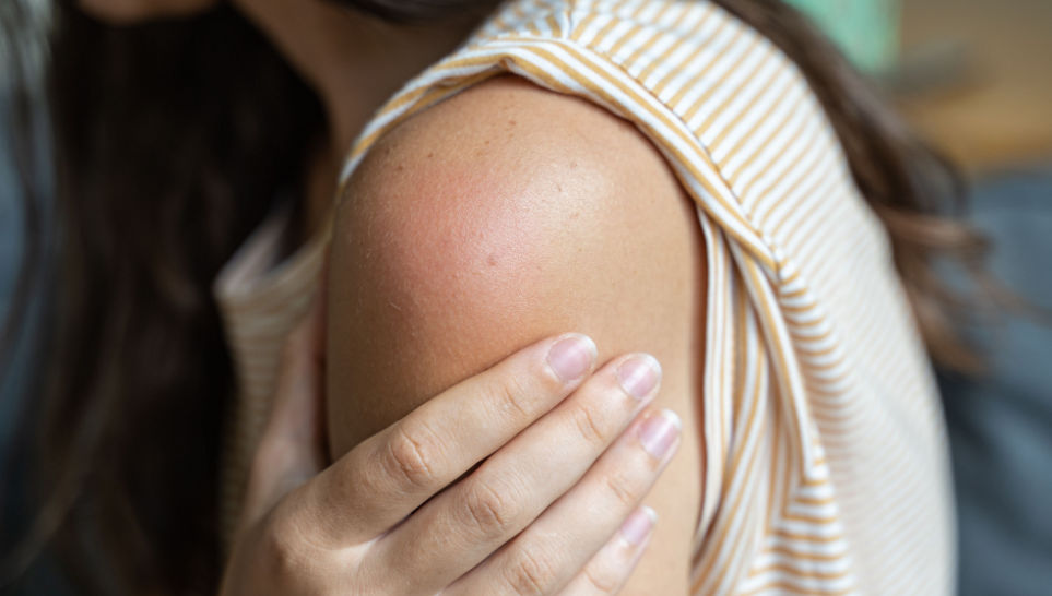 shoulder skin redness side effect of mmr vaccine