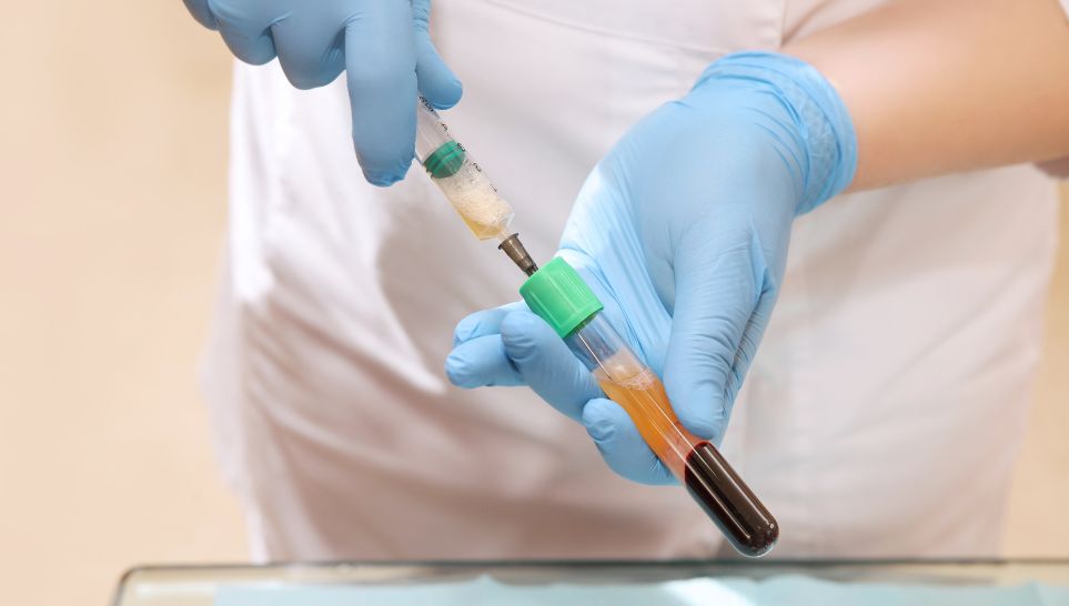 preparation of blood plasma from test tube in syringe